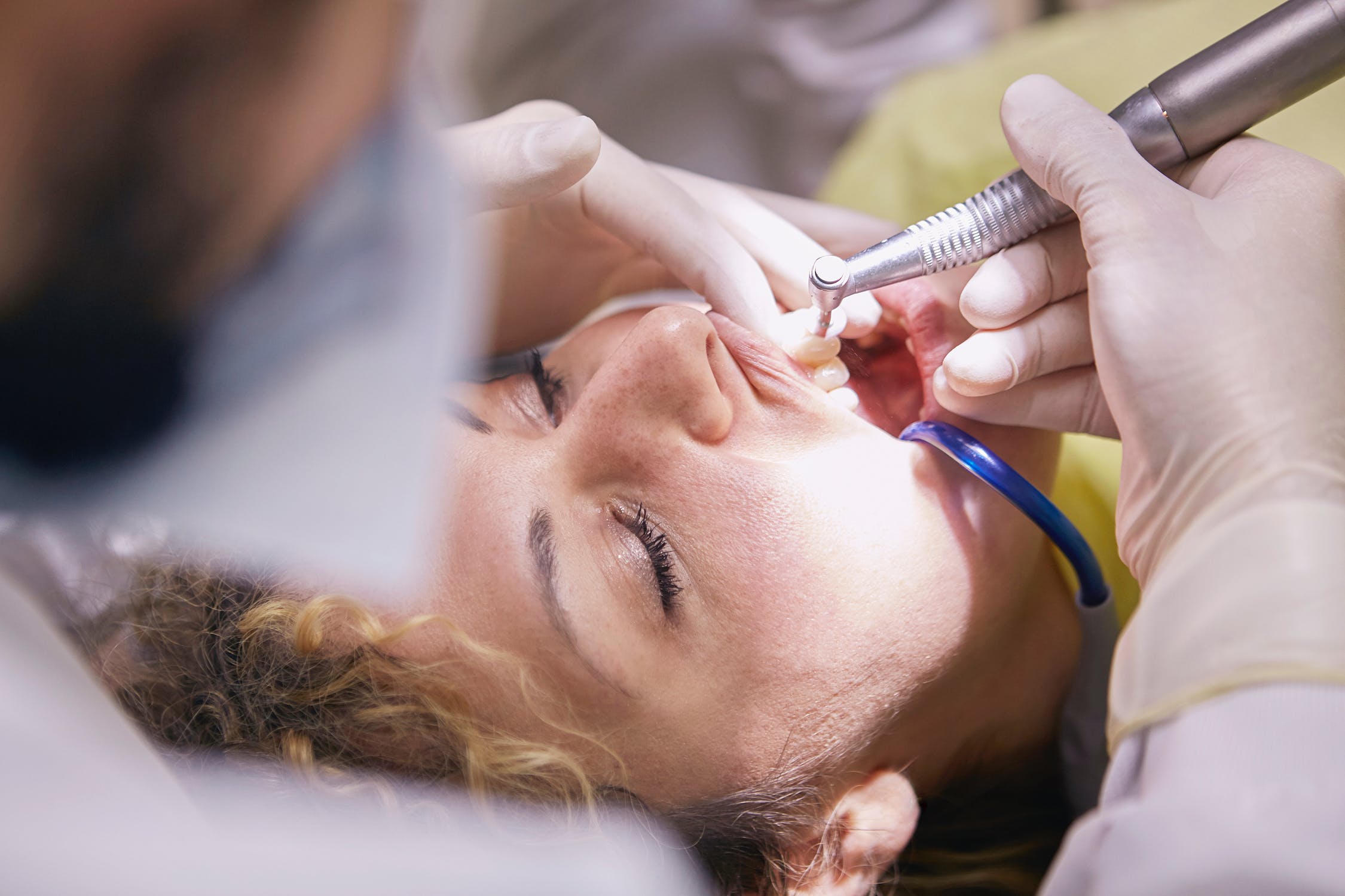 Dental Cleaning